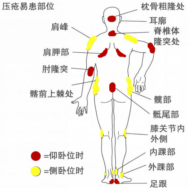 图片 2