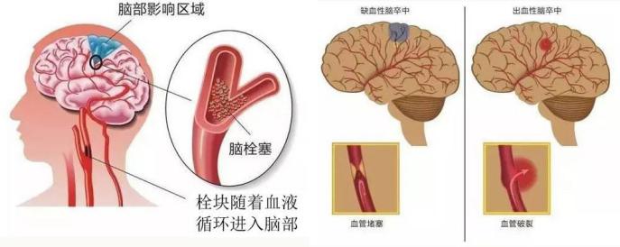 图片 6